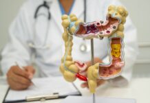 대장암 생존율을 바꾼다! 2025년 최신 치료방법 등장