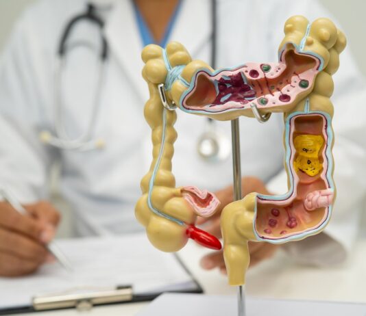 대장암 생존율을 바꾼다! 2025년 최신 치료방법 등장