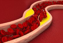 콜레스테롤 낮추는 다양한 최근 방법들