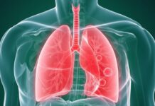 듀크대학교 연구진, 치명적인 폐암의 혁신적 치료 가능성 열다