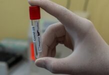 35년 투병한 교사가 도전한 겸상적혈구병 유전자 치료, NC에서 주목하는 이유 듀크대학병원에서 겸상적혈구병 유전자 치료를 받는 환자